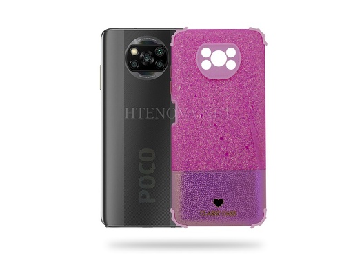 Redmi X3 Glitter Back Case